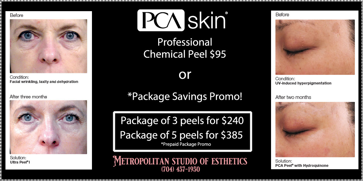 CHEMICAL PEELS in Matthews, NC 28105